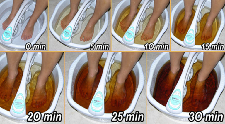 Detox Foot Spa - Ionic Detoxification To Cleanse & Remove Toxins