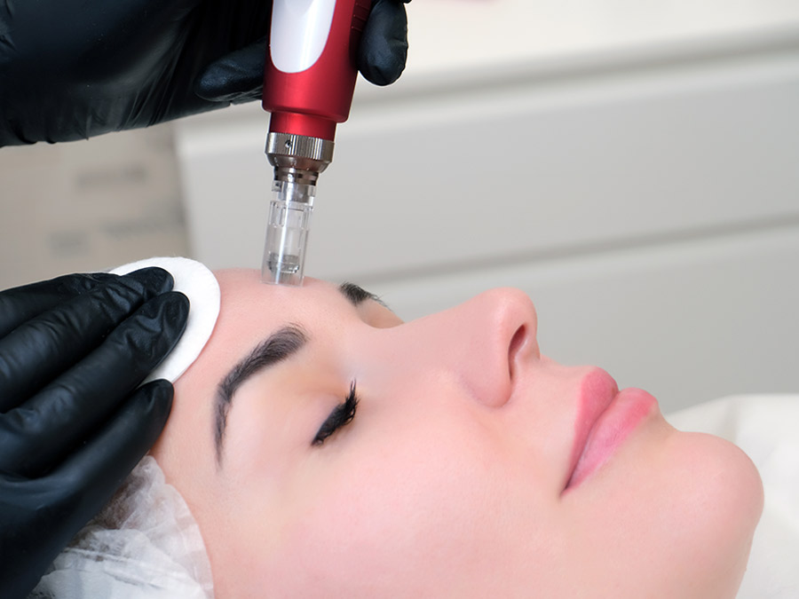 Microneedling Facial