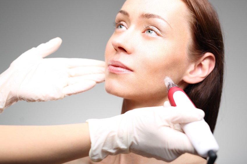 Microneedling Scar Treatment